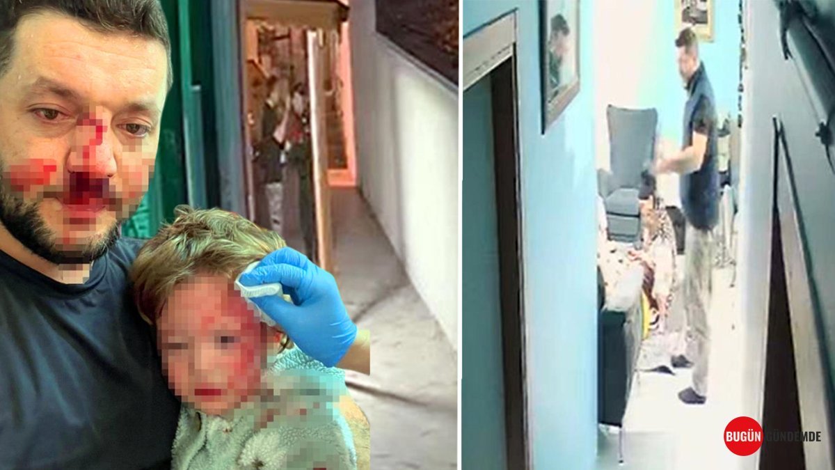 14 Aylık Bebek ve Babasına Vahşi Saldırı Sanığı Serbest! Adalet Yerini Bulacak mı?