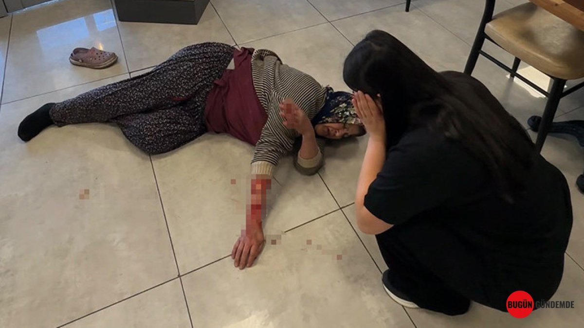 Kan Donduran Olay: Dinlenme Tesisinde Başıboş Köpek Dehşeti! Anne Kolundan Parça Kopardı
