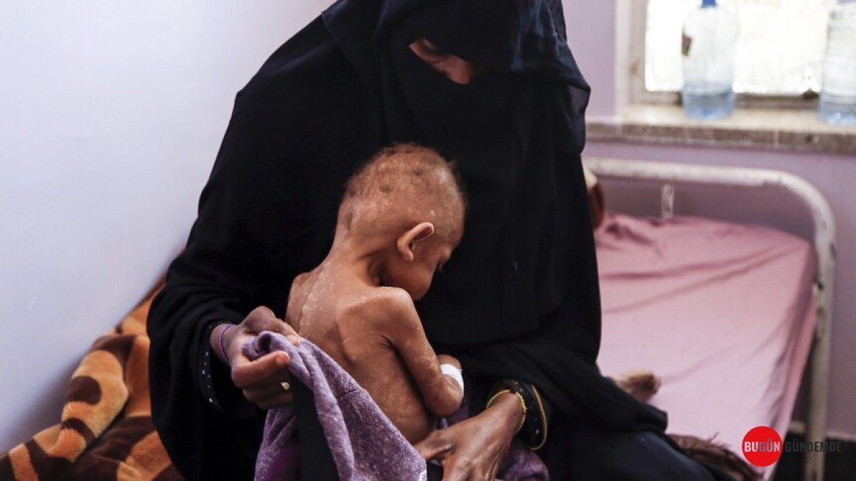 Yemen'de Yıkım!: BM'den Yürek Burkan Açlık Uyarısı: 18 Milyon Kişi Ölümle Pençeleşiyor!